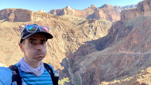 Chris has an exasperated expression with switchbacks in the background